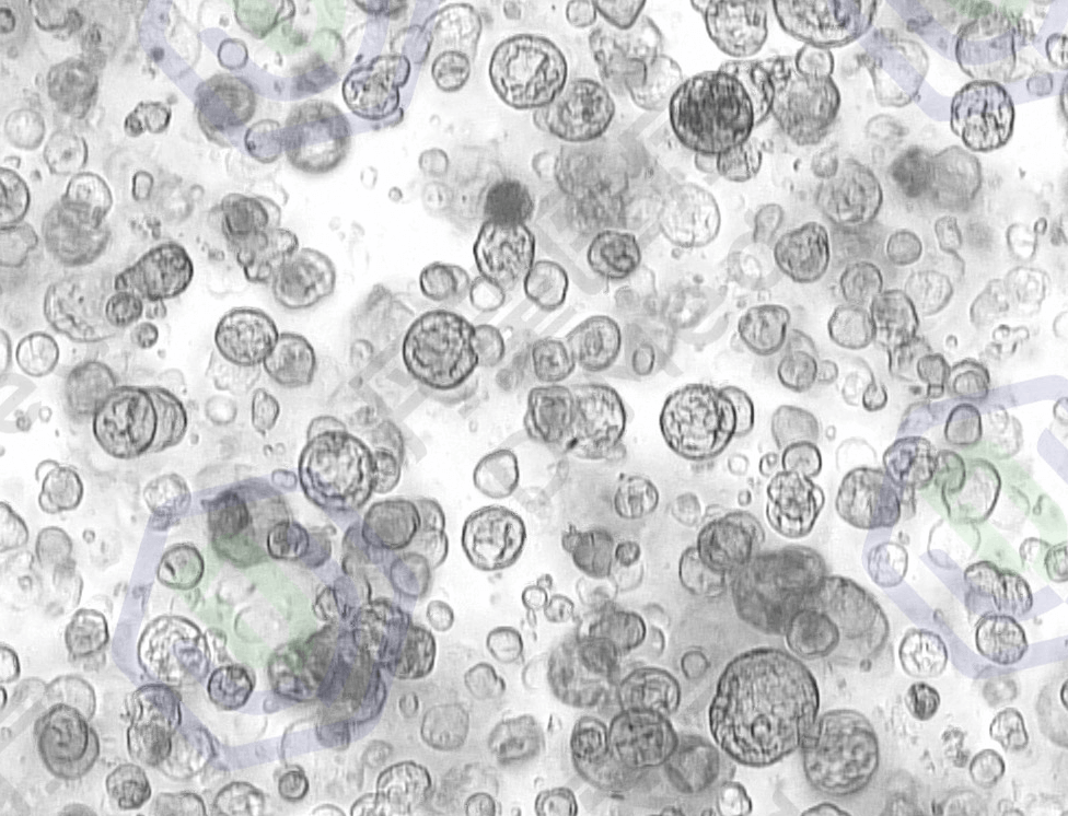 丹望医疗人卵巢癌类器官模型