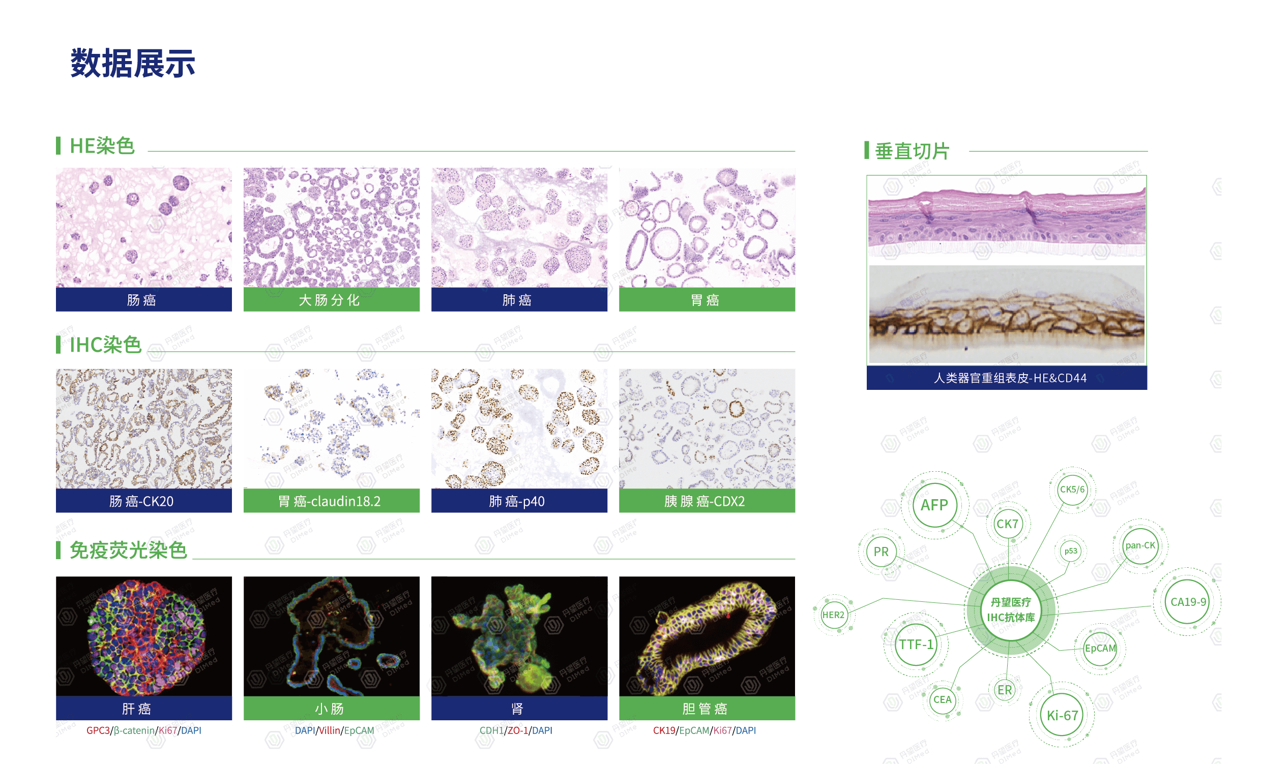 病理1.png